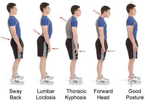 What is Mechanical or Postural Low Back Pain & How to Relieve It? - Upswing  Health